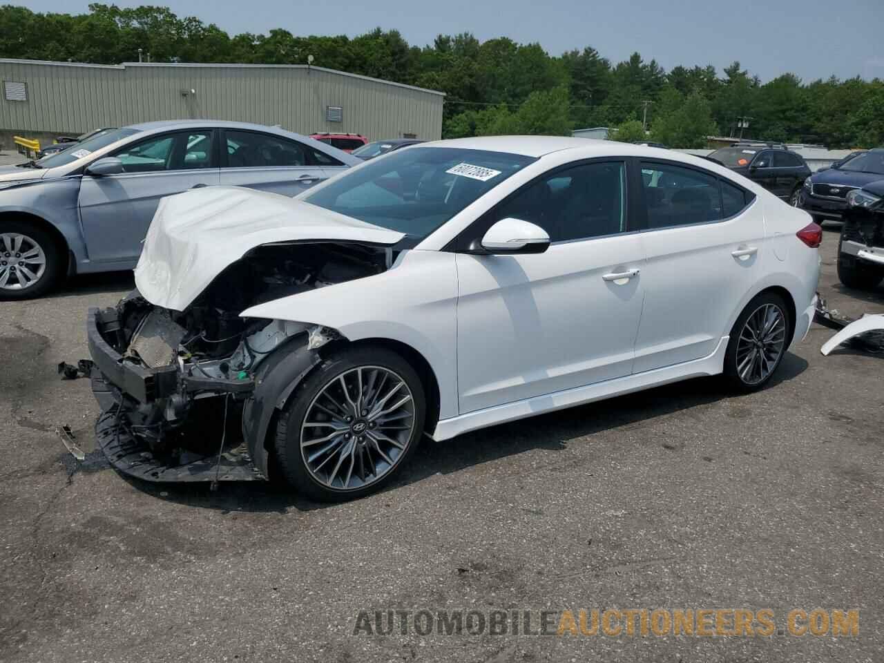 KMHD04LB2HU364085 HYUNDAI ELANTRA 2017